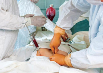 جرعة مخدر ناقصة تسبب استفاقة مريض أثناء عملية جراحية بورزازات