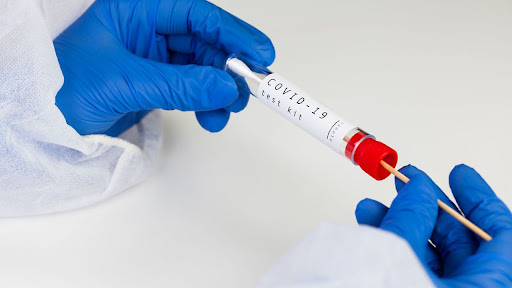 رسميا.. توحيد تسعيرة تحاليل كوفيد “PCR” في 400 درهم