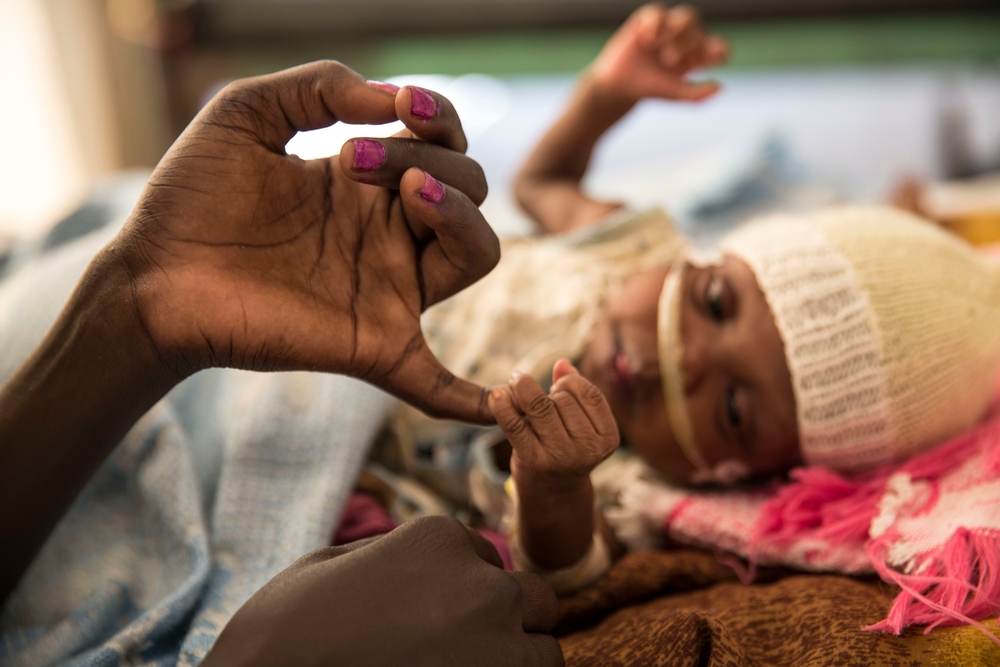 مرض غامض يفتك بالعشرات في جنوب السودان