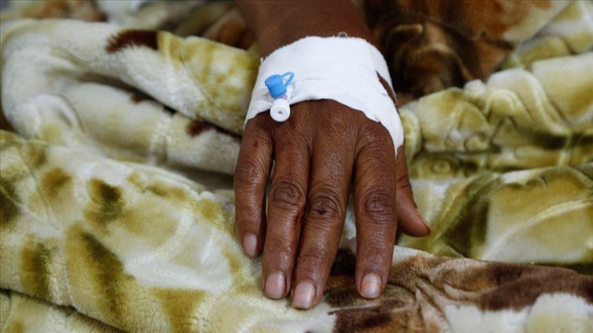 مسؤولة بريطانية تكشف انتشار جدري القرود بين المثليين جنسيا