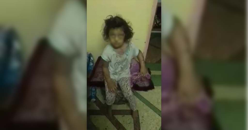 تعذيب أم لطفلتها بالضرب والكي.. أمن سلا يتدخل ويوقف المتهمة