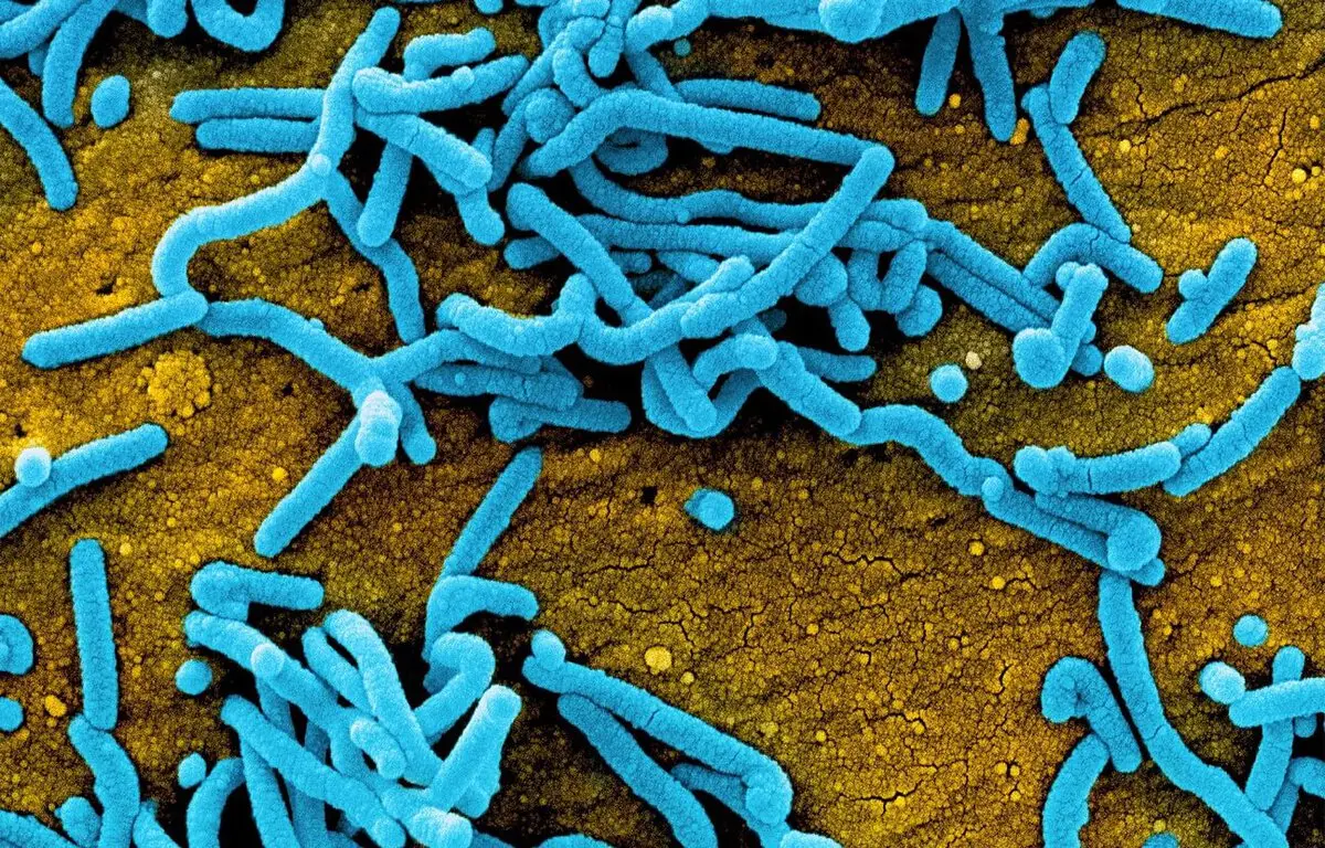 منظمة الصحة تعلن تفشي فيروس “ماربورغ” بغانا