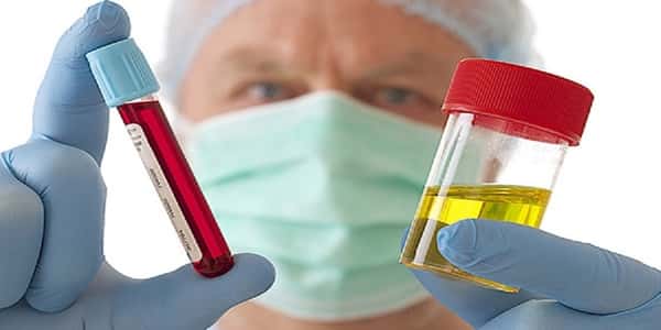 ابتكار فحص سريع لاكتشاف أمراض السرطان
