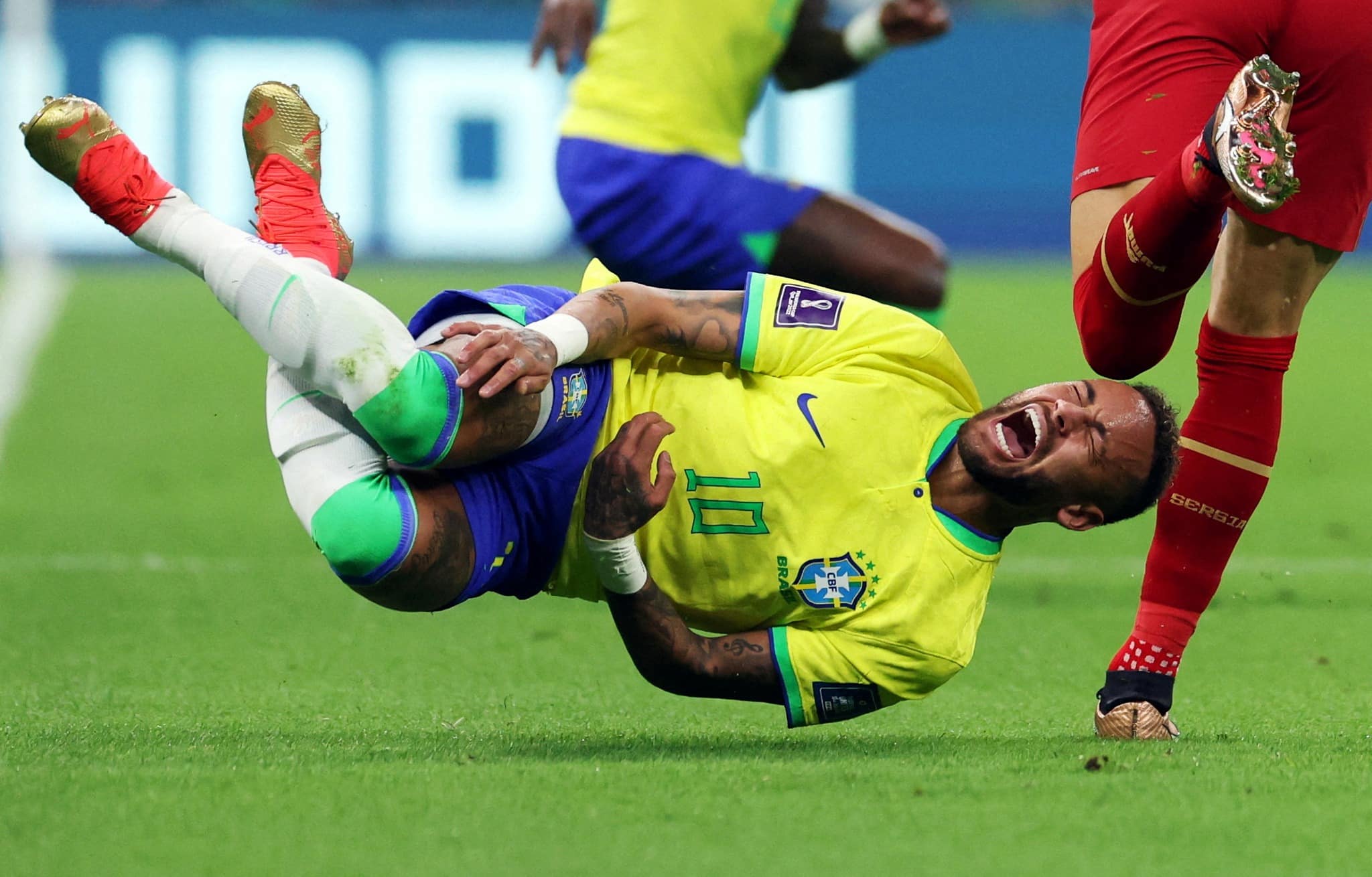 إصابة نيمار هل تبعده عن كأس العالم؟ مدرب البرازيل يجيب