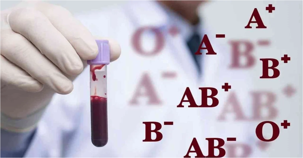 دراسة: أصحاب فصيلة الدم A أكثر عرضة للإصابة بسكتة دماغية مبكرة
