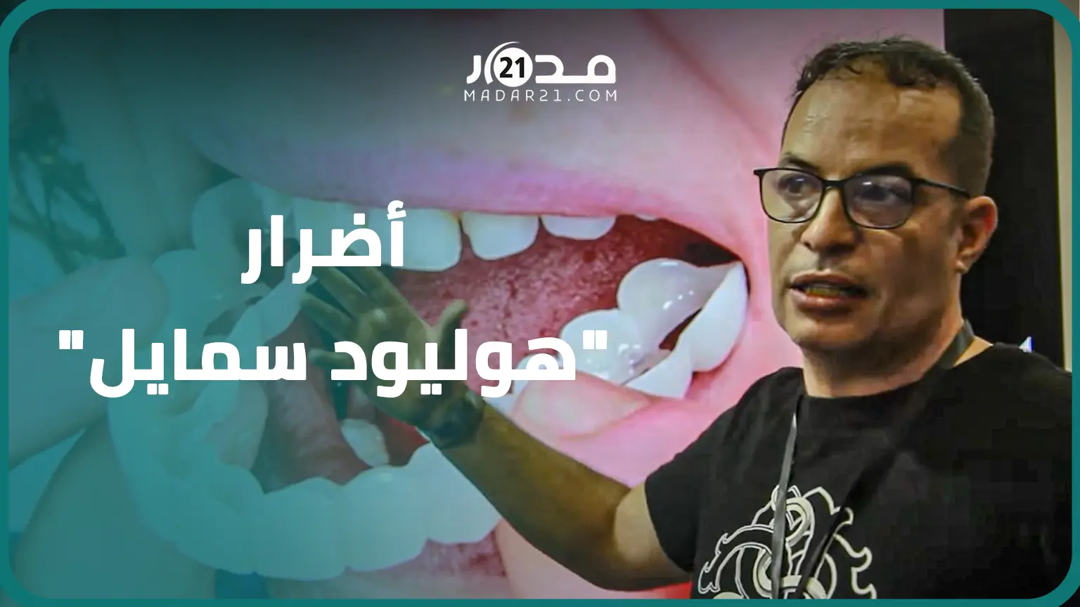 قد تسبب أمراضا خطيرة.. اختصاصيون وأطباء أسنان يكشفون أضرار “هوليود سمايل” ويحذرون المغاربة
