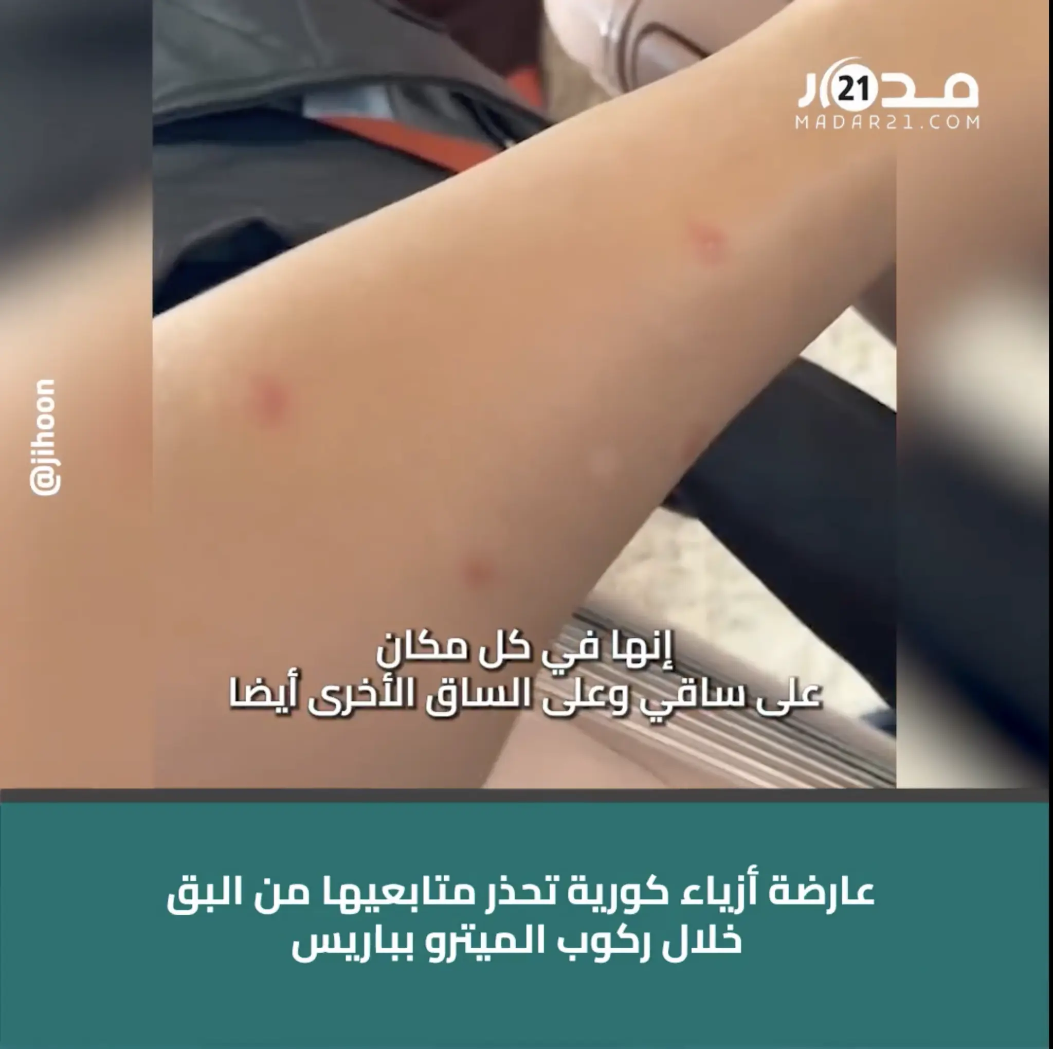 عارضة أزياء كورية تحذر متابعيها من البق خلال ركوب الميترو بباريس