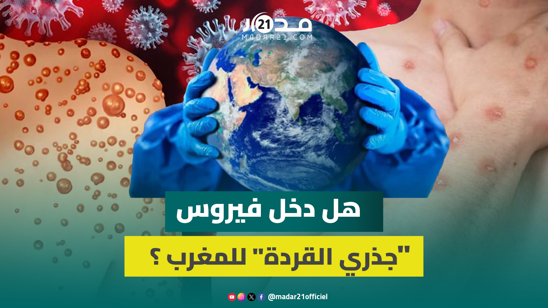 هل دخل فيروس “جذري القردة” المغرب؟…