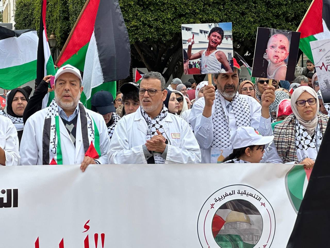 أطباء مغاربة يدعون الحكومة لفتح أبواب المستشفيات بالمملكة لاستقبال جرحى غزة