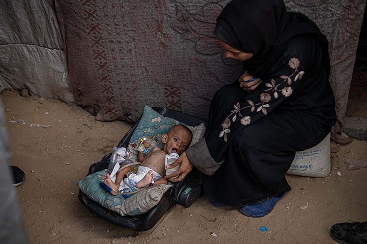 سرطان ونزوح وجوع.. رضيع فلسطيني يواجه ثلاثية الموت