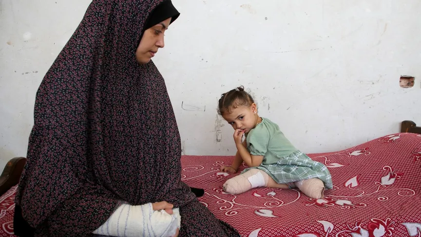 الأمم المتحدة: غزة تؤوي أكبر عدد من الأطفال مبتوري الأطراف