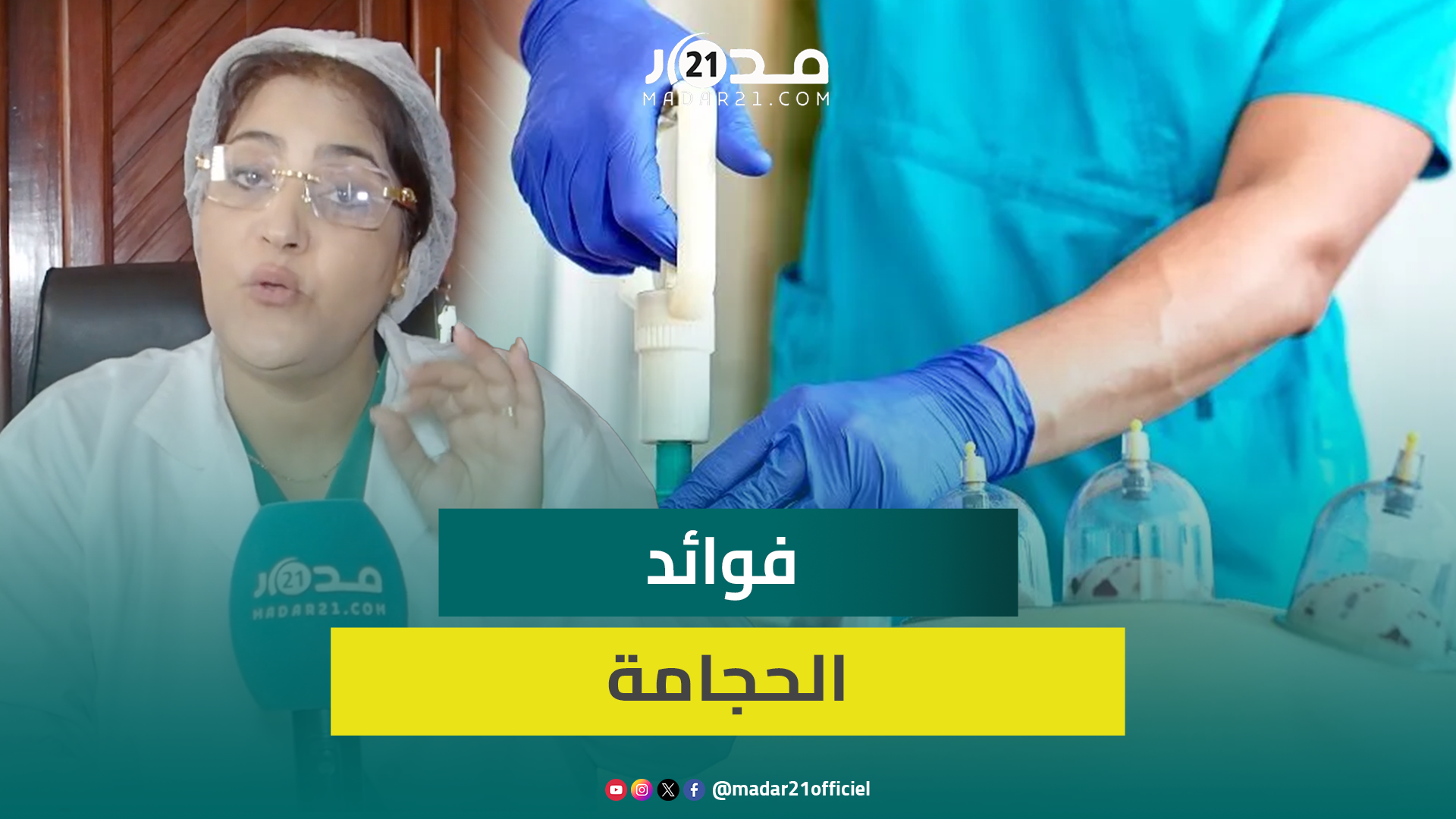 أخصائية في الطب الصيني تُعدِّد فوائد الحجامة على الصحة وتوصي بها في كل شهر