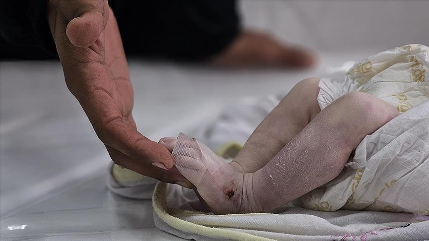 الإبادة الإسرائيلية لأطفال غزة.. قتل وإعاقة وحرمان من التعليم والعلاج