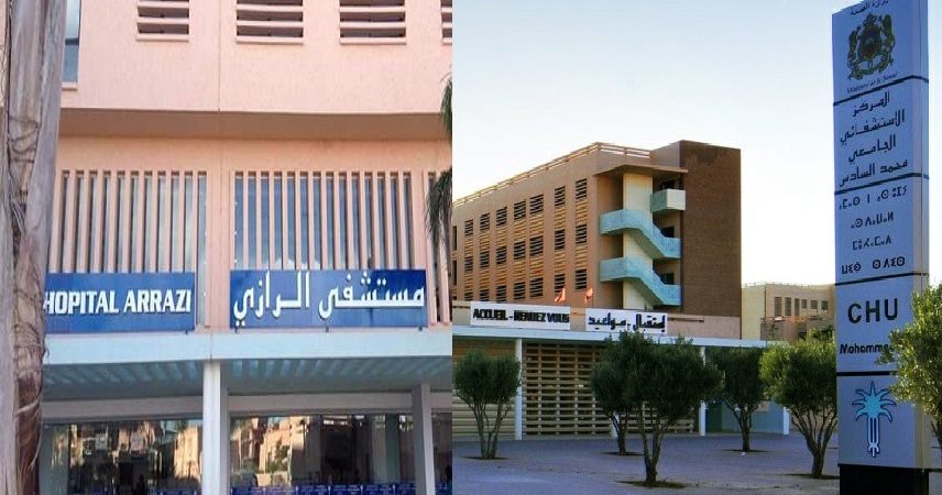 نجاح عملية إعادة زرع يد مبتورة بمراكش