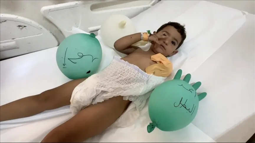 الطفل أحمد.. جائع ومبتور اليد في مستشفى بلا أدوية بغزة