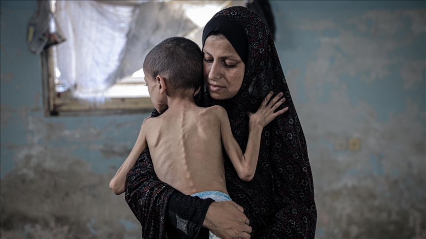 1.2 مليون طفل بغزة يعانون انعدام أمن غذائي حاد