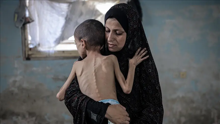 1.2 مليون طفل بغزة يعانون انعدام أمن غذائي حاد