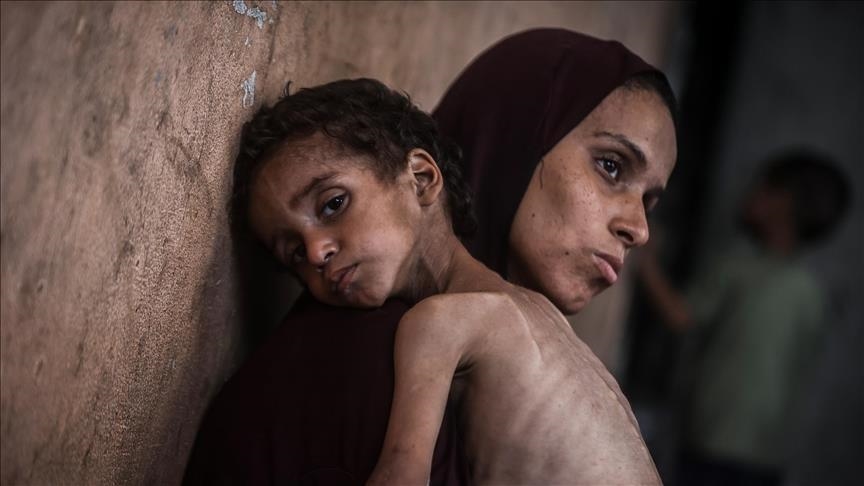 صحة غزة تعلن إصابة فلسطينيين بأعراض مرض مجهول
