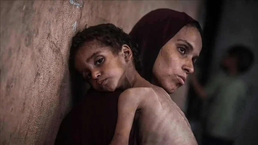 صحة غزة تعلن إصابة فلسطينيين بأعراض مرض مجهول