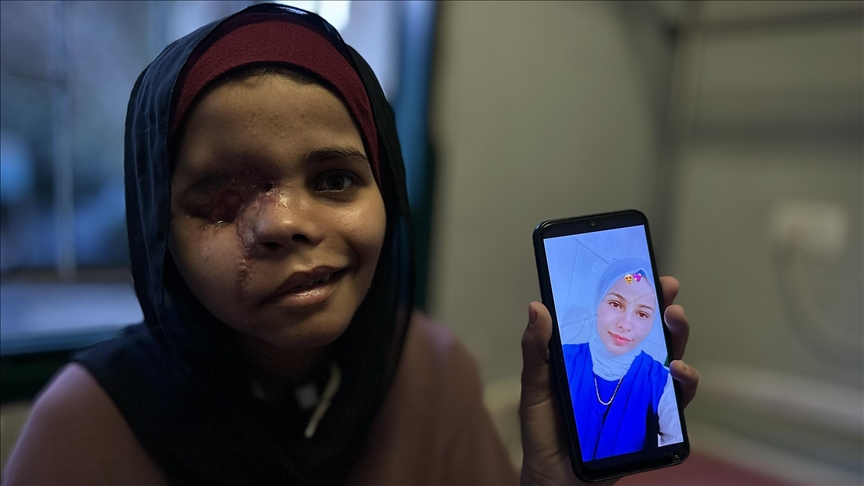 من لهو الطفولة إلى عتمة المستشفى.. عين ندى تحكي وجع غزة