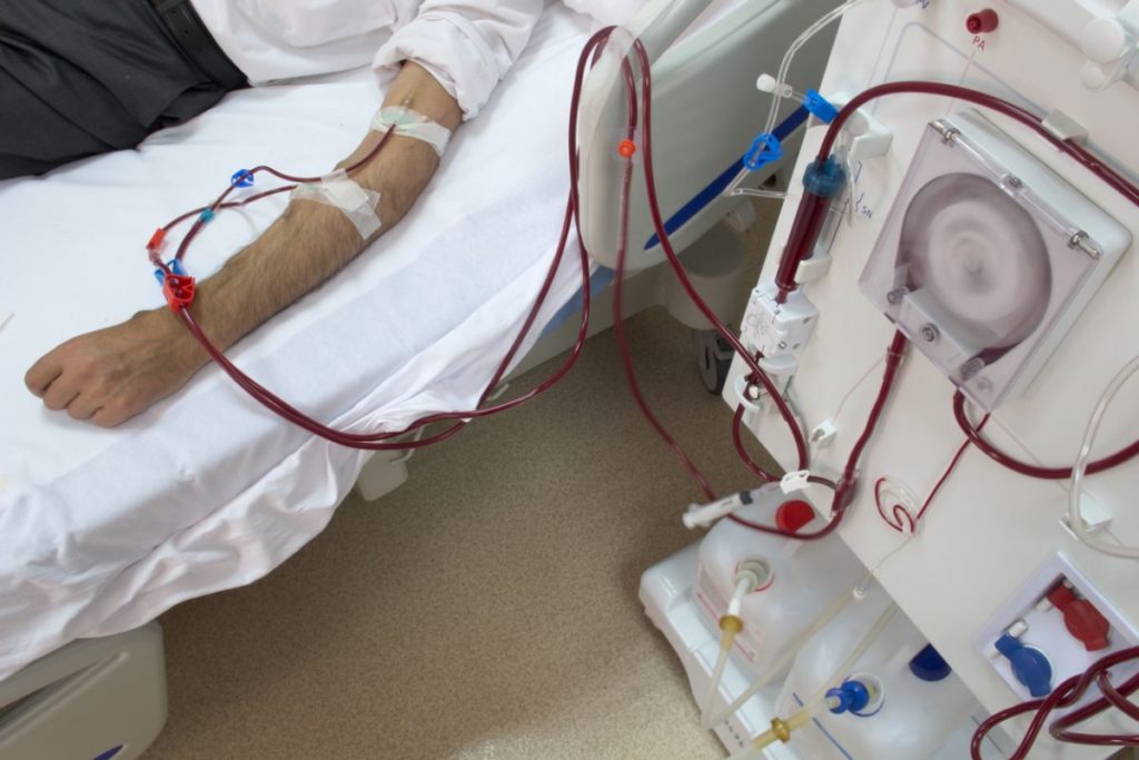 بين قسوة الغسيل الكلوي وضيق الأمل.. معاناة يومية لآلاف المرضى بالمغرب