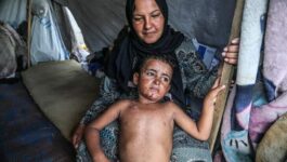 خيام مكتظة ودواء شحيح.. “جدري الماء” يستشري في غزة