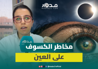 كسوف الشمس.. طبيبة عيون تكشف مخاطر الظاهرة على شبكية العين