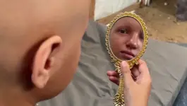 “أحلم أن يعود شعري”.. أمنية طفلة أنهكتها حرب الإبادة بغزة